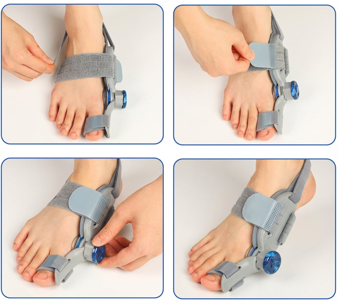 Correcteur d’oignon